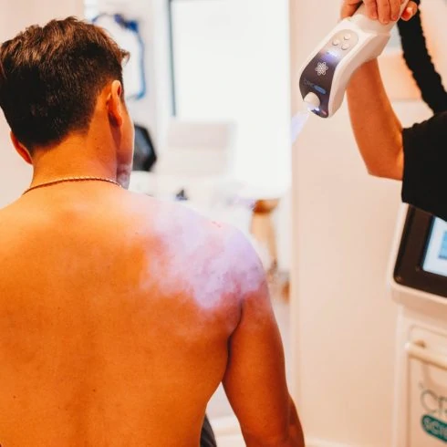 Man receiving Localized Spot Cryotherapy treatment on shoulder and upper back.