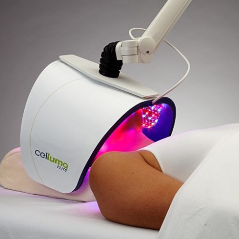 Customer receiving Celluma Elite Light Therapy treatment.